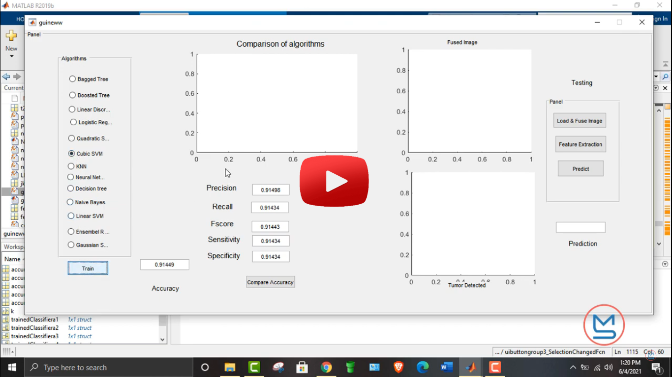 Brain tumor detection using different machine learning algorithm using matlab Video