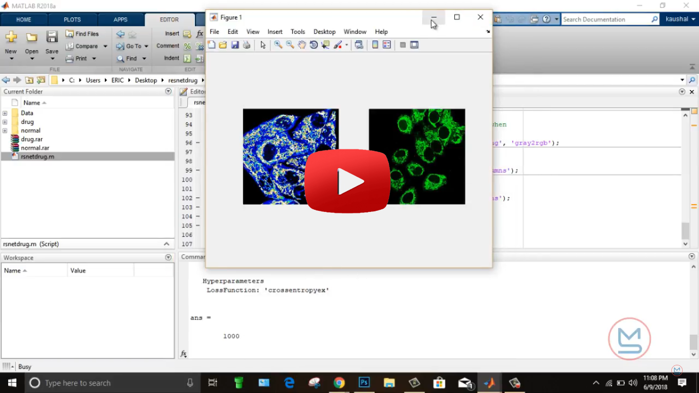 detection of drugged cells and normal cell using deep learning with matlab 